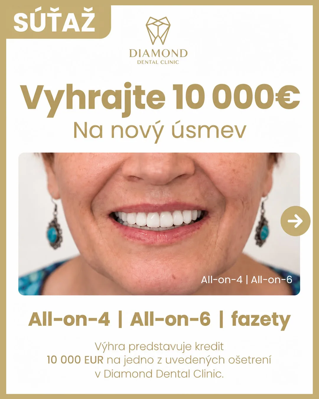 Súťaž: Vyhrajte 10 000 € na nový úsmev – All-on-4, All-on-6 alebo fazety. Výhra predstavuje kredit 10 000 EUR na jedno z uvedených ošetrení v Diamond Dental Clinic.